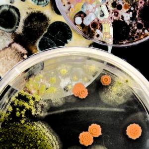 MycoTOX Profile® (urine) - Mold Exposure